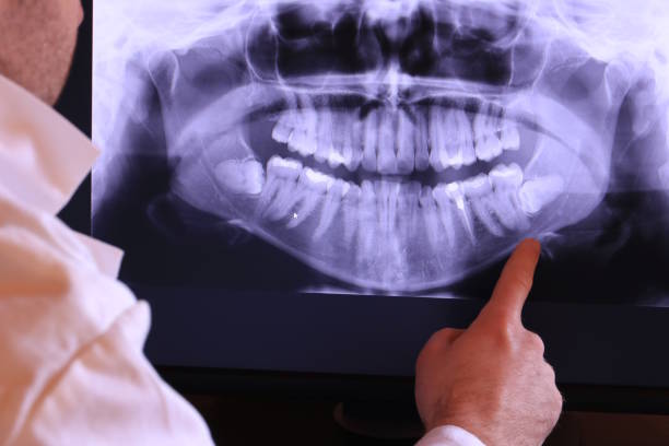 Best Weekend Emergency Dentist in Wild Peach Village, TX