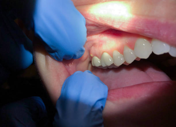 Best Emergency Dental Services for Seniors in Wild Peach Village, TX