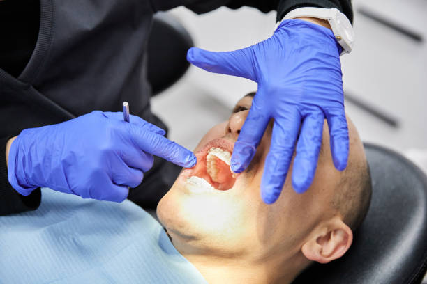 Best Pediatric Emergency Dentist in Wild Peach Village, TX